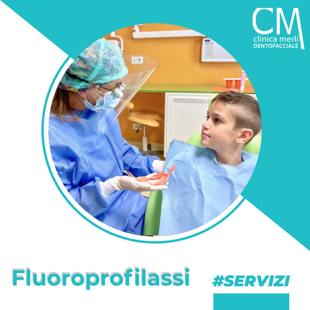 Fluoroprofilassi - Clinica Merli • Dentisti Rimini | Morciano Di ...